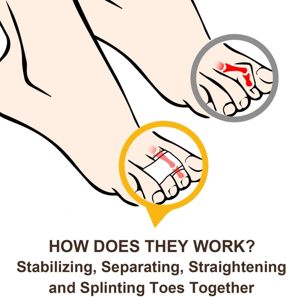 Welnove Hammer Toe Straightener