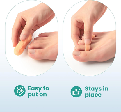 Welnove Hammertoe Corrector Gel Toe Straighteners