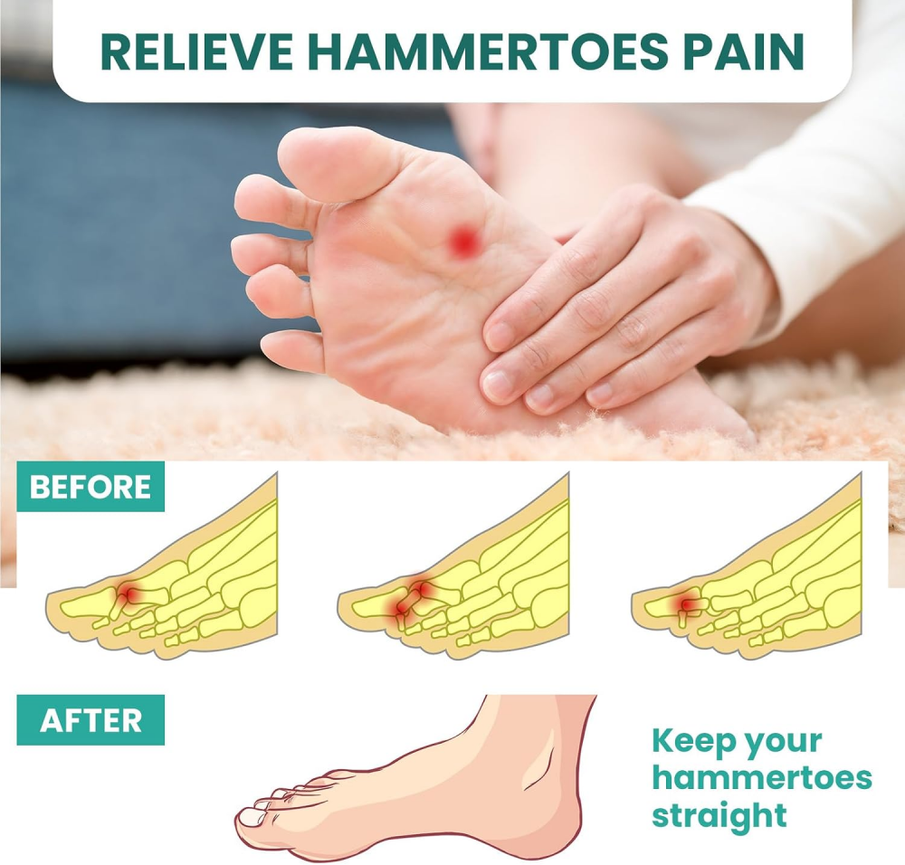 Welnove Hammertoe Corrector Gel Toe Straighteners