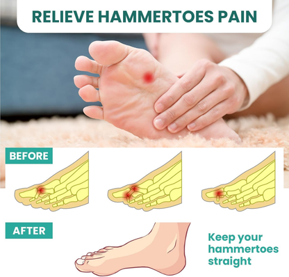 Welnove Hammertoe Corrector Gel Toe Straighteners