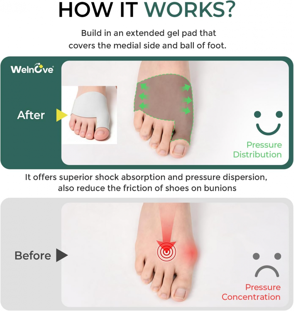 Welnove Metatarsal Pads with Bunion Relief