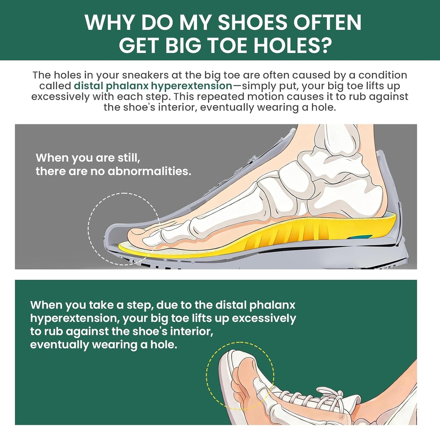 Welnove Shoes Big Toe Holes Preventor