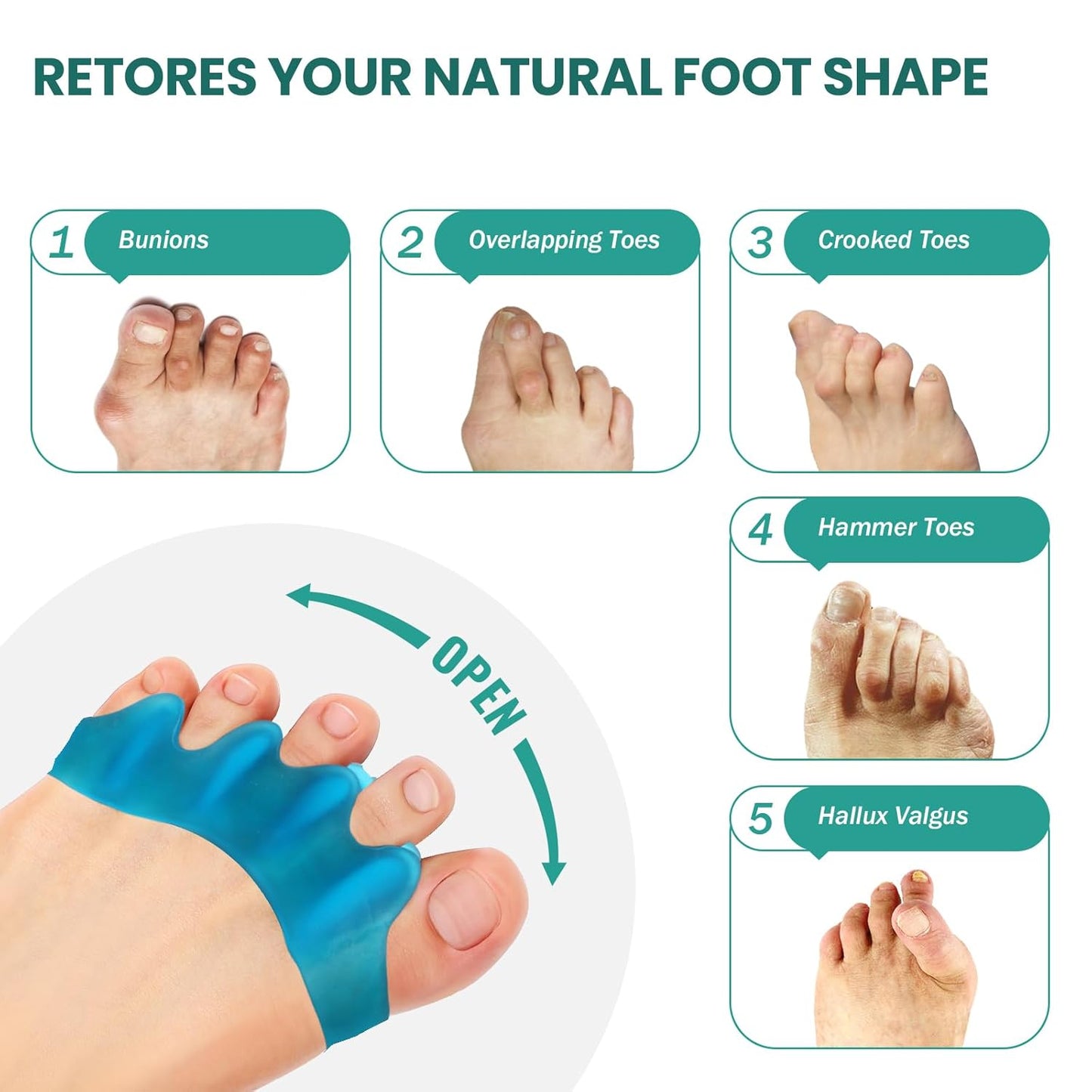 Welnove Silicone Toe Separators for Correct Bunion