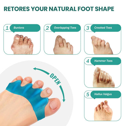 Welnove Silicone Toe Separators for Correct Bunion