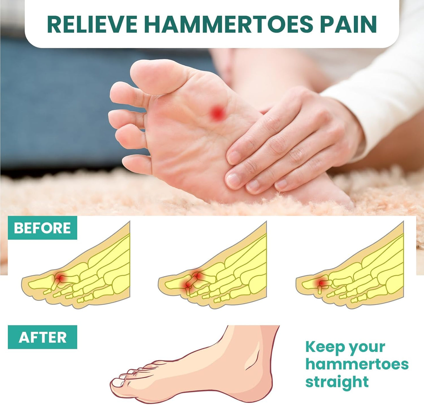 Welnove Hammer Toe Crests Straightener, 4 Pcs, 3 Loop